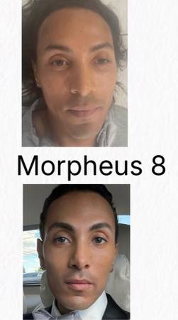 Skin care , waxing , Morpheus 8, body sculpting, tattoos …. - beauty services