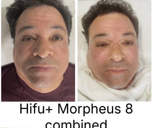 Skin care , waxing , Morpheus 8, body sculpting, tattoos …. - beauty services
